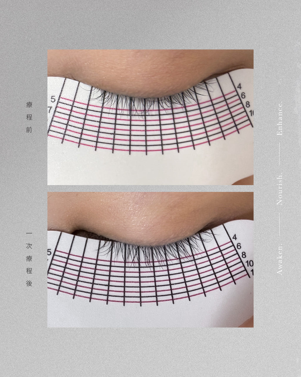 Lash Regrowth 開毛囊孕睫術