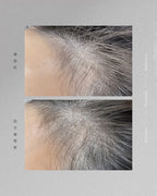 Lash Regrowth 開毛囊孕睫術
