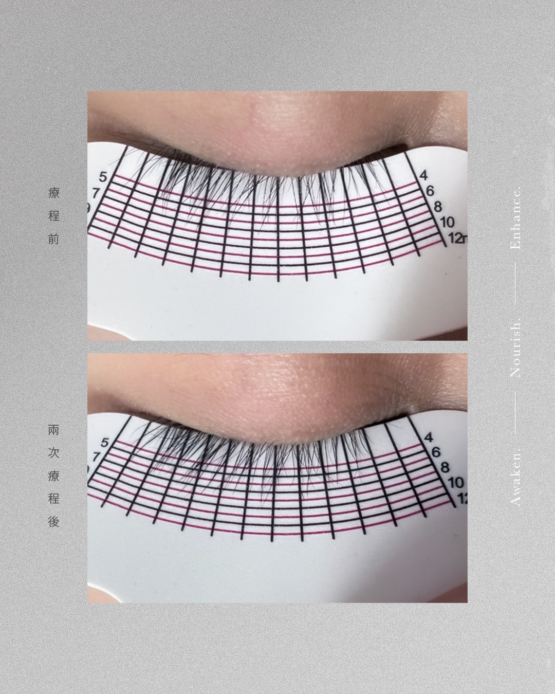 Lash Regrowth 開毛囊孕睫術